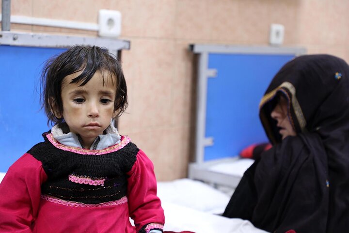 شمار کودکان دچار سوءتغذیه در افغانستان افزایش یافته است