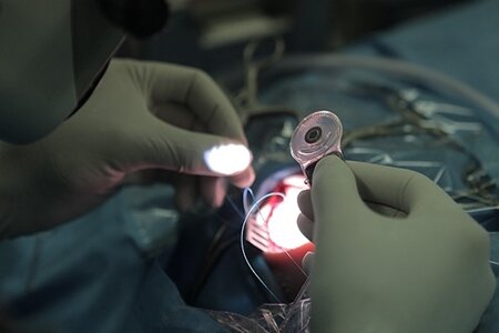 180 کودک تا پایان دی ماه تحت عمل جراحی کاشت حلزون قرار می گیرند
