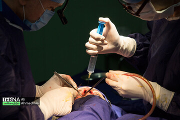 جراحی رینو پلاستی به روش بسته