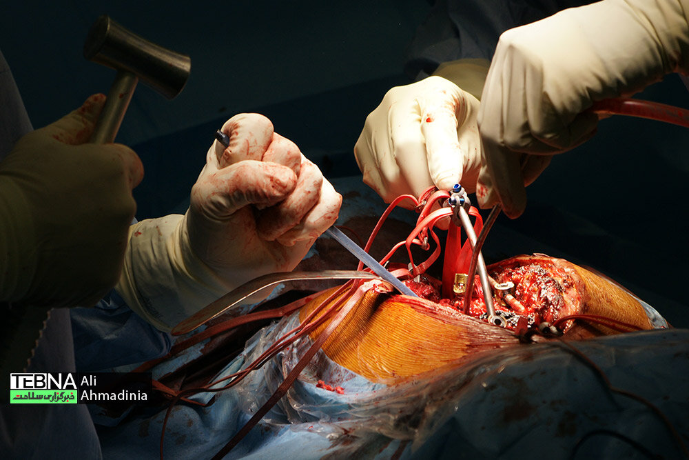 انجام بیش از 5 هزار عمل جراحی در بیمارستان نورافشار