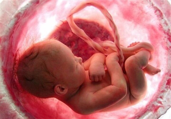 عمده سقط جنین‌ها هیچ ربطی به پزشکی و غربالگری ندارند