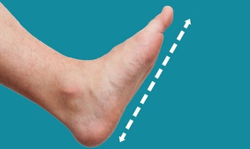 دلایل  و عوارض صافی کف پا را بشناسید/ شنا سبب تقویت عضلات کف پا می‌شود