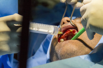 سمپوزیوم متریال ها و تکنیک های پیوند استخوان در جراحی های دهان