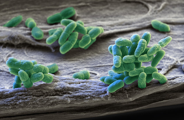 شناسایی دو مورد ابتلا به وبا در جیرفت
