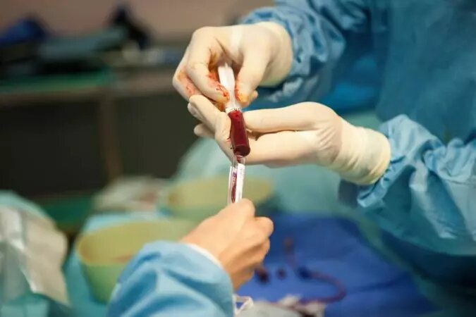 درمان 21 نوع بیماری با پیوند مغز استخوان در دانشگاه علوم پزشکی مشهد