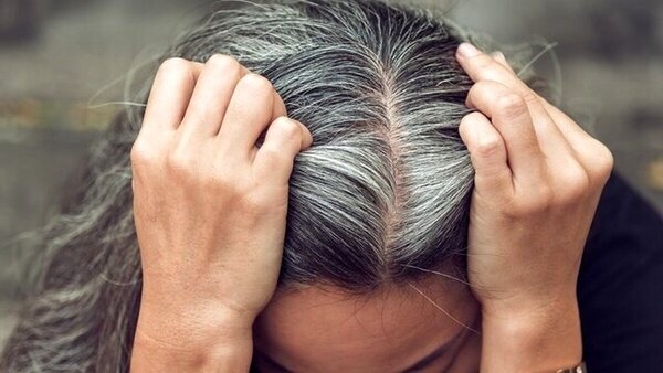 آیا استرس واقعا عامل سفیدشدن مو است؟