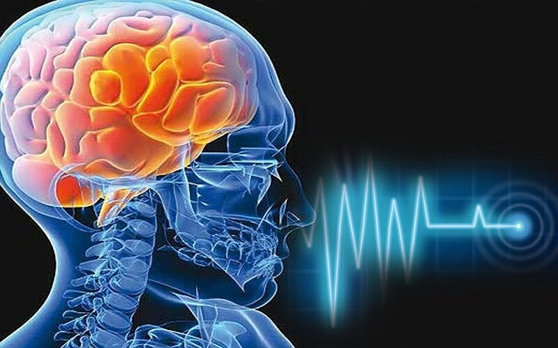 مصرف داروهای روان گردان و محرک؛ عامل کاهش سن بروز سکته مغزی