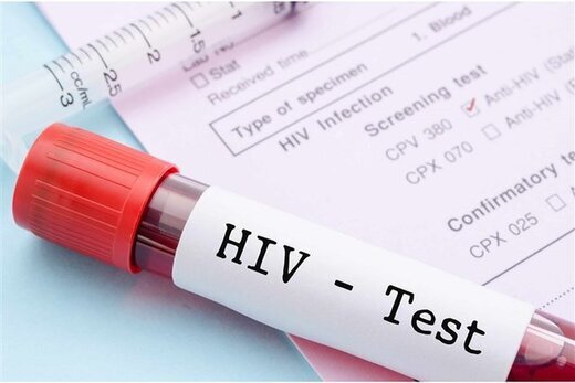 خدمت رسانی به بیماران مبتلا به ویروس HIV رایگان است