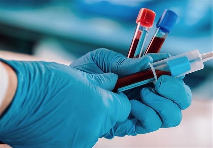 درمان قطعی ۸۰ بیماری خونی با سلول‌های بنیادی