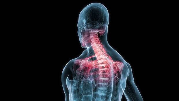 ۷ علت گردن درد هنگام خوابیدن و بیدار شدن