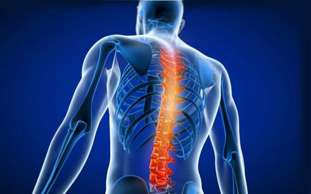 بلوک‌ های عصبی در درمان التهاب مفاصل کمر