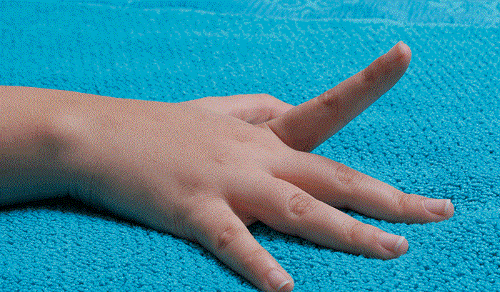 انگشت ماشه ای عارضه‌ای شایع بین زنان و هنرمندان صنایع دستی
