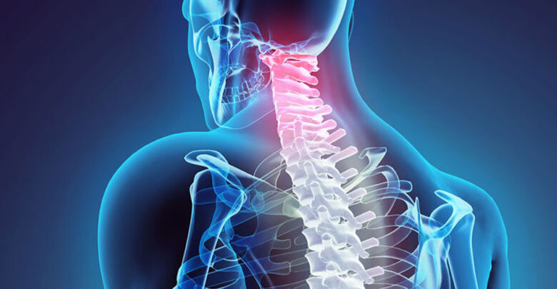 عمل دیسک گردن: تعویض یا فیوژن کدام بهتر است؟