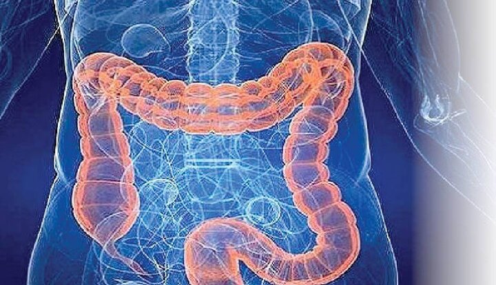 چگونه التهاب و کمبود آهن رانش پیری در روده را تسریع می‌کند؟