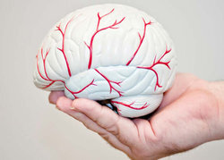 افراد با گروه خونی  A در معرض سکته مغزی قرار دارند