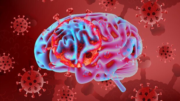 آلزایمر غیر قابل درمان است/ رایج ترین نوع زوال عقل