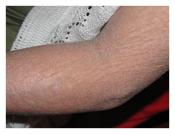 درمان خشکی پوست پا با روش های خانگی