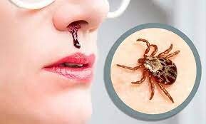 کریمه کنگو مهم ترین و گسترده ترین بیماری ویروسی