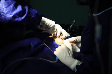 رینو پلاستی جراحی شایع در ایران