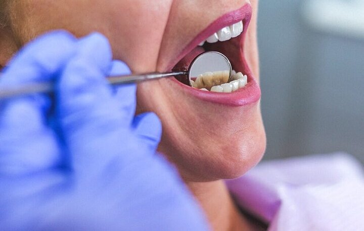 چالش‌های سلامت دهان و دندان در ایران