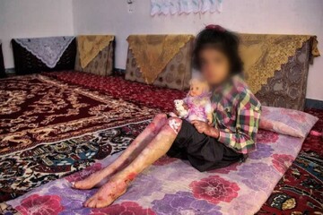 خانه‌ای‌بی؛ تداوم خدمت به بیماران پروانه‌ای در روزهای اختلال ارتباطات