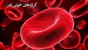 شناسایی گروه خونی نادر موسوم به O+(D--) در کرمان