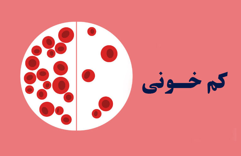 همه چیز درباره کم خونی و وضعیت شیوع بیماری همه چیز درباره کم خونی و وضعیت شیوع بیماری