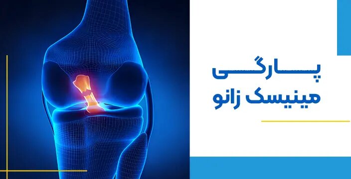 از پارگی مینیسک زانو چه می‌دانید؟