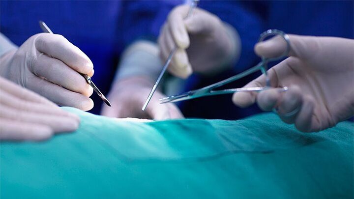 ۳۶ هزار عمل جراحی و یک میلیون بستری در نوروز ۱۴۰۲