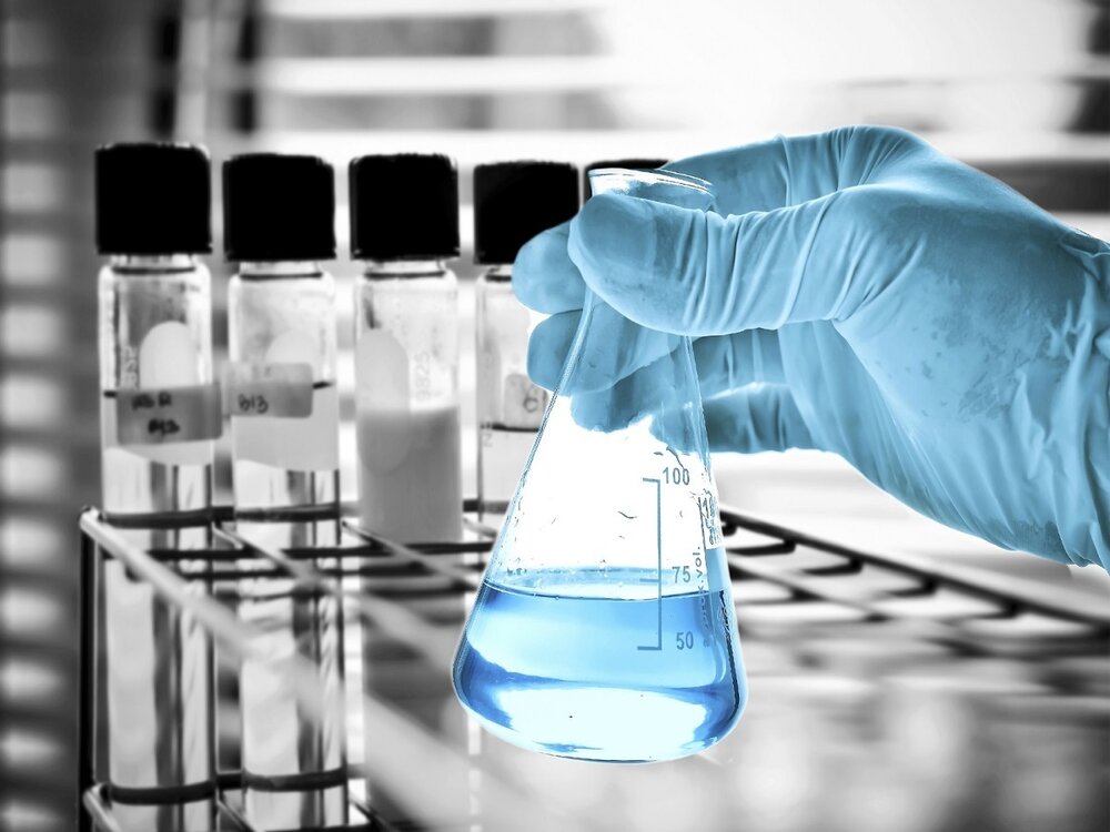 تشخیص آلزایمر با یک آزمایش ساده تشخیص آلزایمر با یک آزمایش ساده