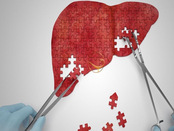 اهدای عضو جوان بمی، نجات بخش زندگی یک بیمار در شیراز شد