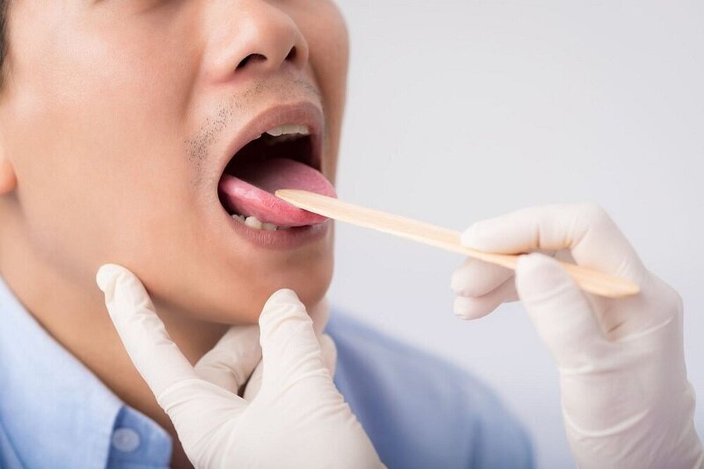 تلخی دهان از چه بیماریهایی خبر میدهد؟ تلخی دهان از چه بیماریهایی خبر میدهد؟