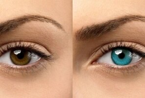 خطرات جراحی تغییر رنگ چشم را جدی بگیرید خطرات جراحی تغییر رنگ چشم را جدی بگیرید