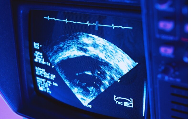 آیا غربالگری‌های بارداری اجباری هستند؟