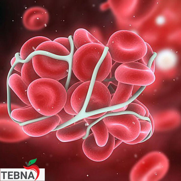 باور های غلط درباره هموفیلی