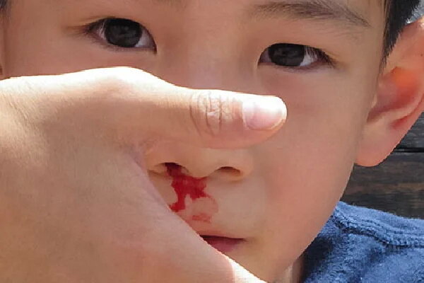 باور های غلط درباره هموفیلی