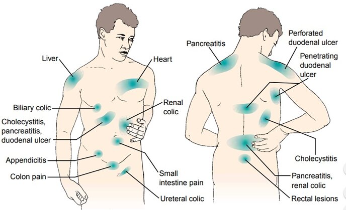 ایا کبد چرب باعث کمر درد میشود؟