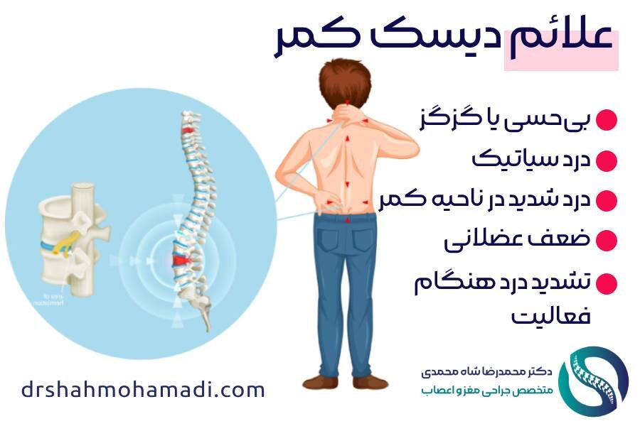 علائم دیسک کمر - دکتر محمدرضا شاه محمدی متخصص درمان دیسک کمر