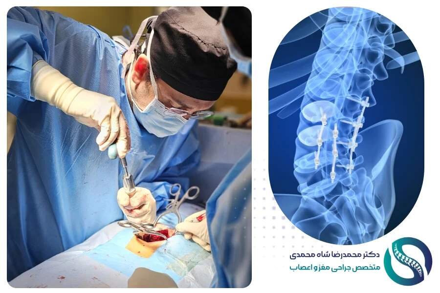 عمل جراحی دیسک کمر - دکتر محمدرضا شاه محمدی