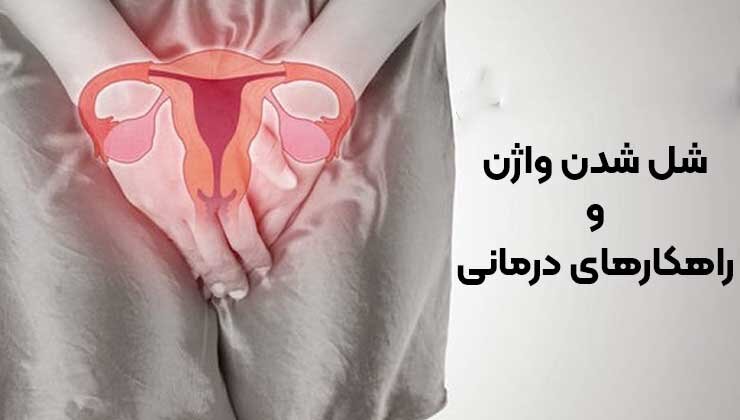 شل شدن واژن و راهکارهای درمانی