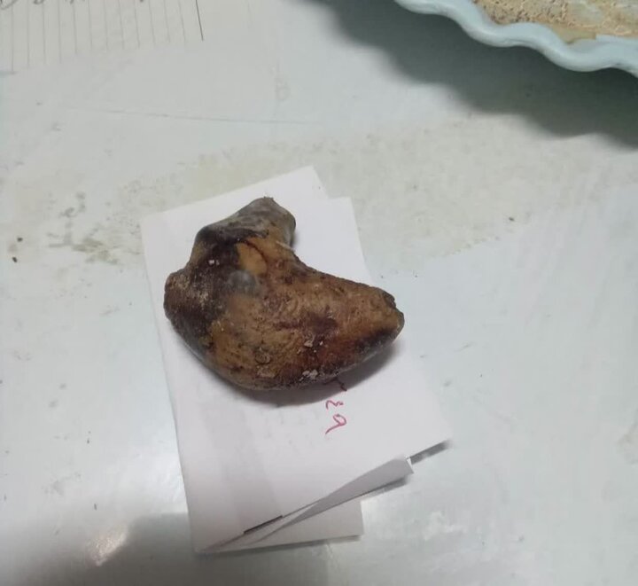 وضعیت سلامت آب و ارتباط آن با تشکیل سنگ‌ کلیه‌ های بزرگ در روستاهای خواف