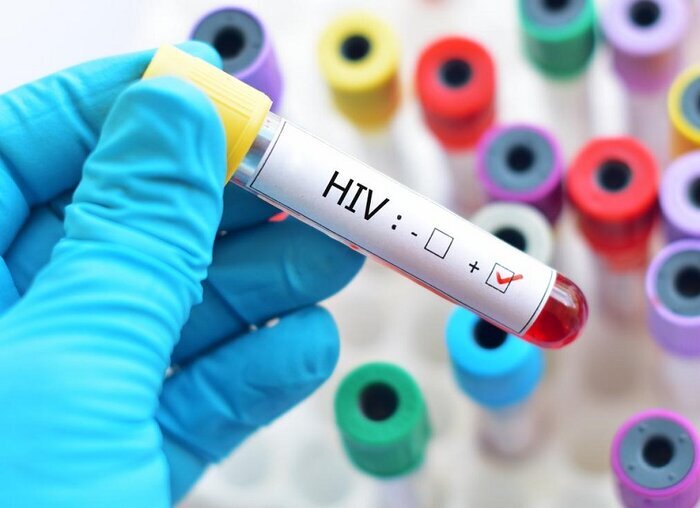 روند افزایشی موارد ابتلا به HIV در مشهد / هشدار درباره شیوع در گروه سنی جوان و میانسال روند افزایشی موارد ابتلا به HIV در مشهد / هشدار درباره شیوع در گروه سنی جوان و میانسال