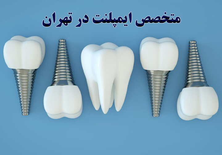 متخصص ایمپلنت دندان
