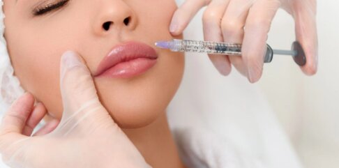 تزریق کدام نوع ژل زیبایی برای شما مناسب است؟