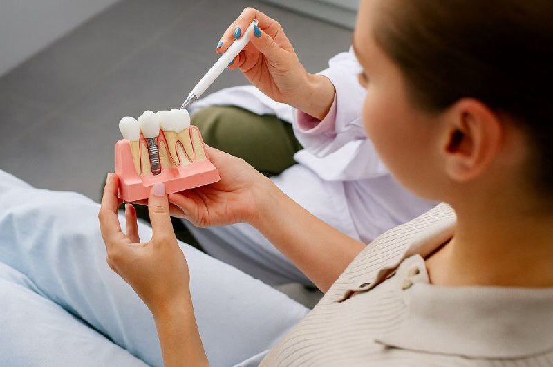 قیمت ایمپلنت کرهای