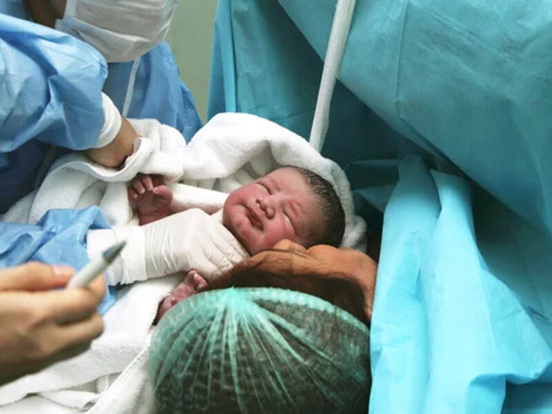 ضرورت غربالگری بینایی نوزادان در هفته های اول تولد