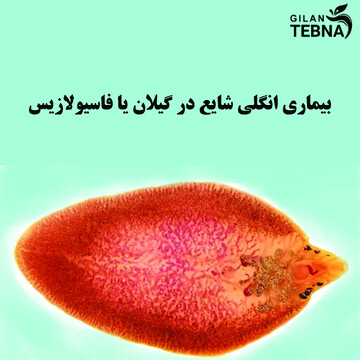 بیماری انگلی شایع در گیلان یا فاسیولازیس