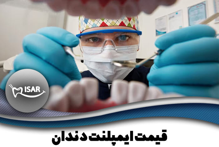 قیمت ایمپلنت دندان