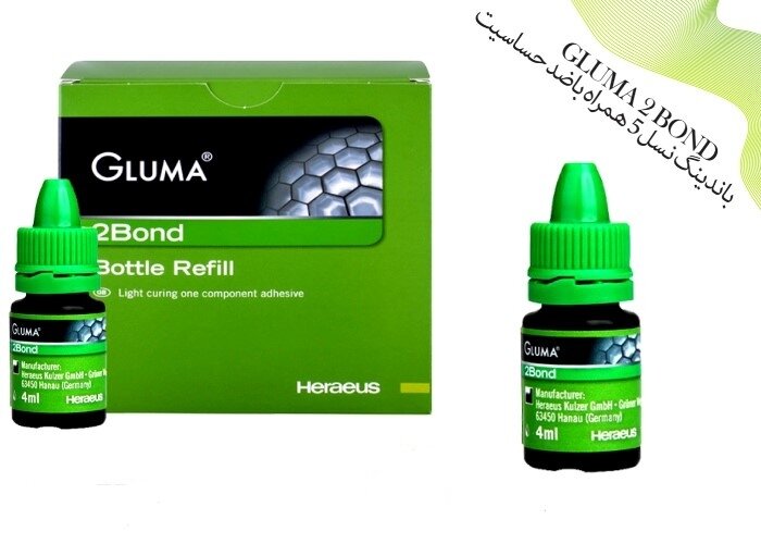 باندینگ دندان چیست