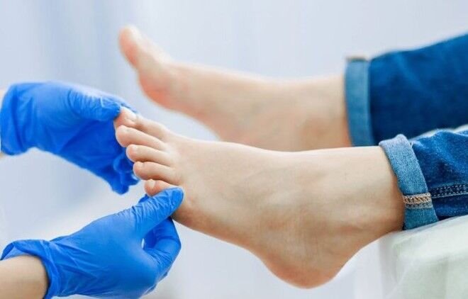 راهکارهایی ساده برای اصلاح انگشتان پا